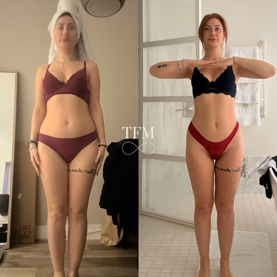Carla, before and after
