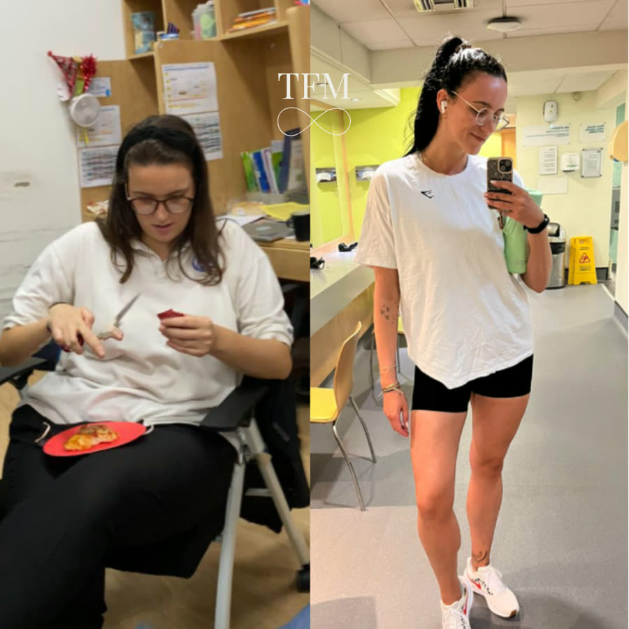 Claudia, before and after