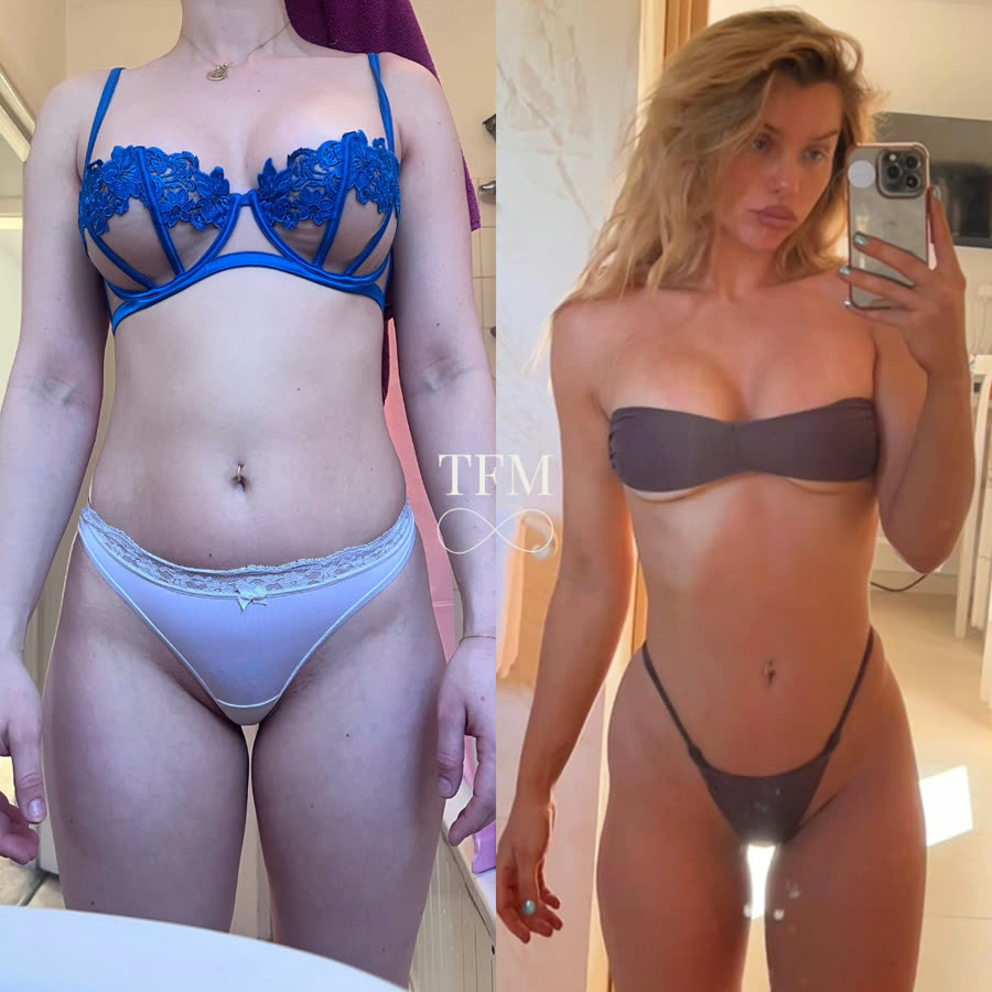 Hayley, before and after