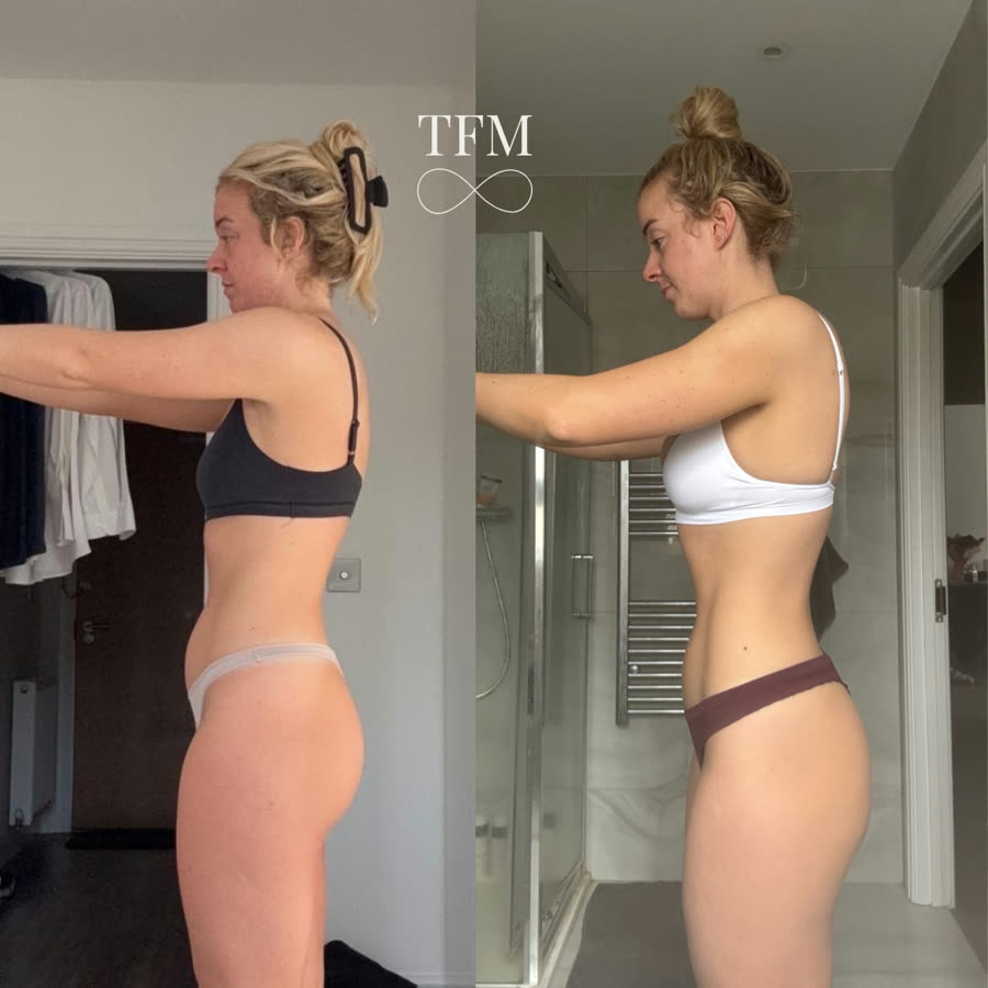 Maddie, before and after